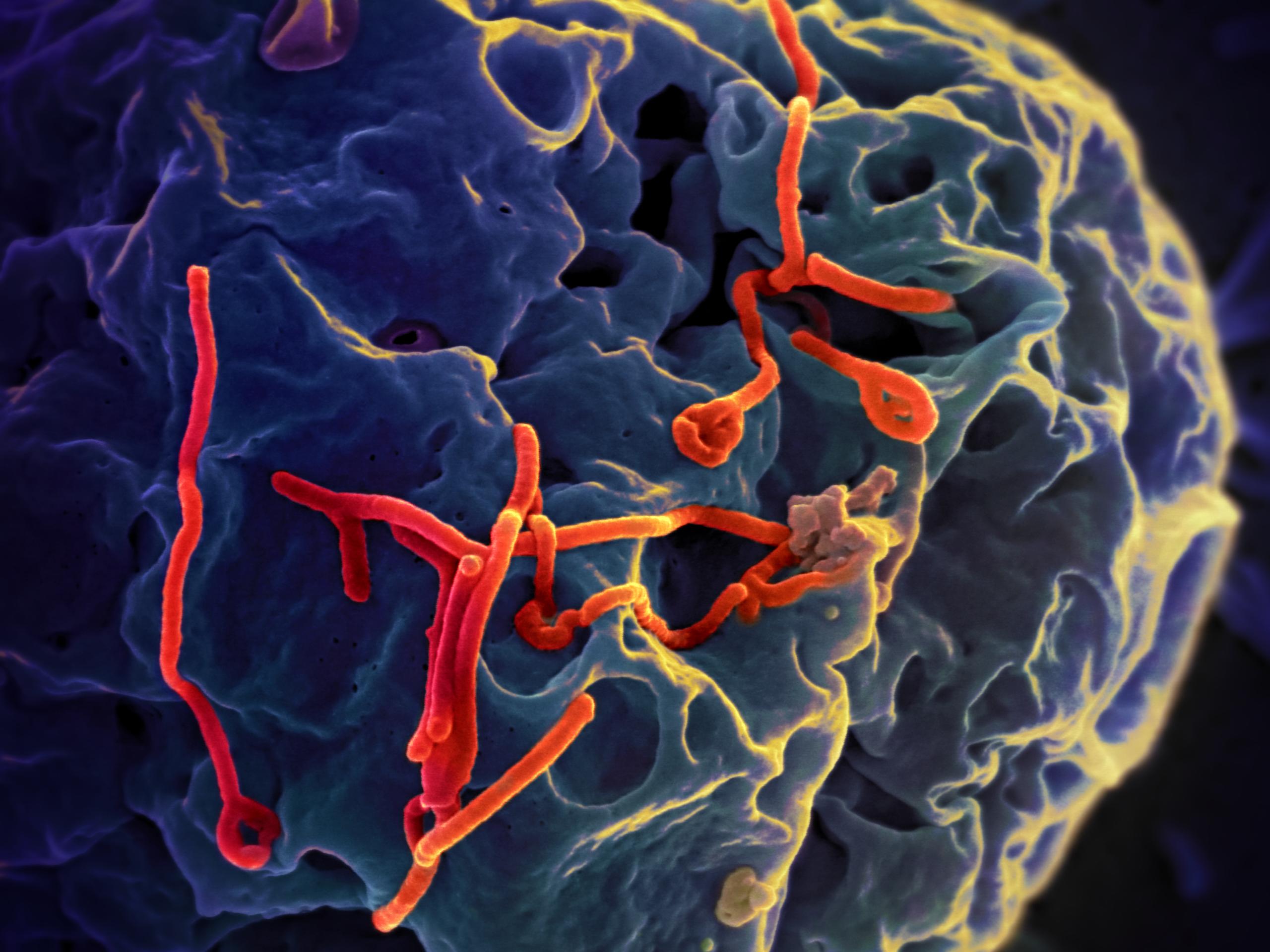 Ebola and genetic modification. Ebola virus. cred - NIAID