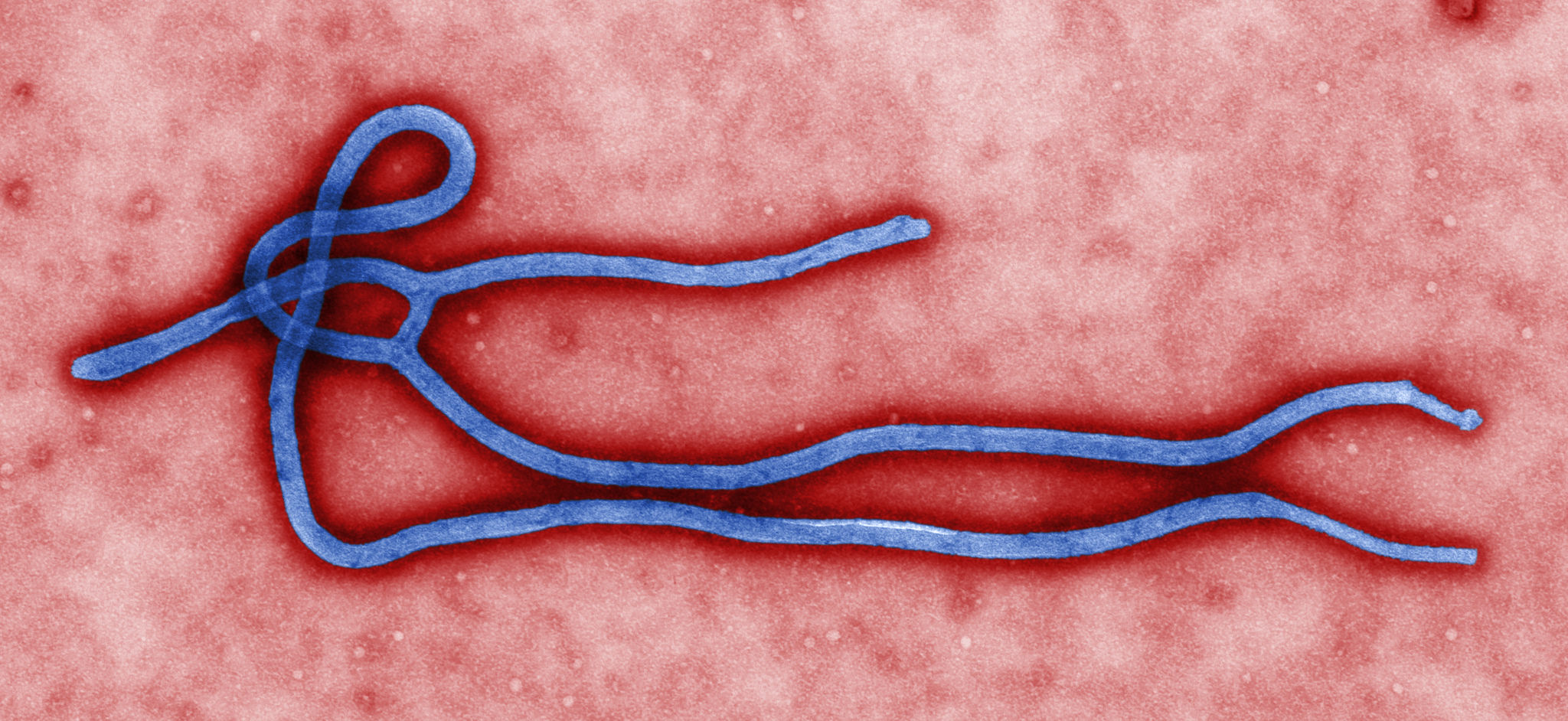 Ebola epidemic changing how we do development. CDC Global